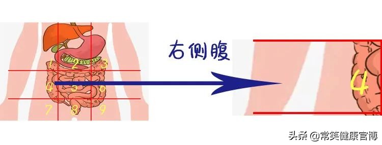 肚子疼胀痛部位对照表,肚子疼是哪里有问题一张图告诉你