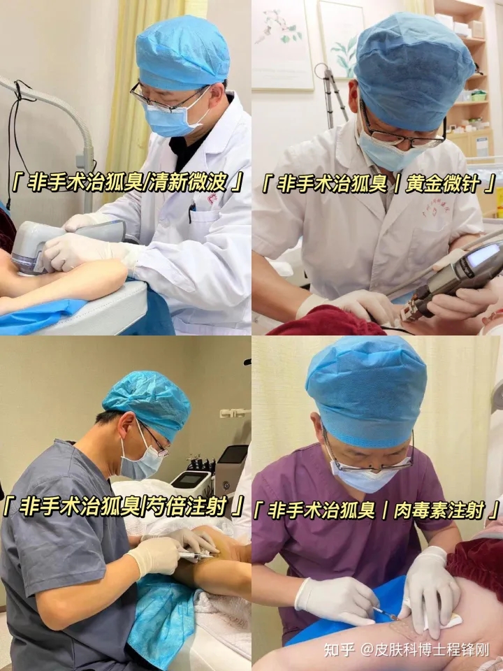 以前没有狐臭怀孕后期为什么有了,之前没有狐臭突然有了会自愈吗