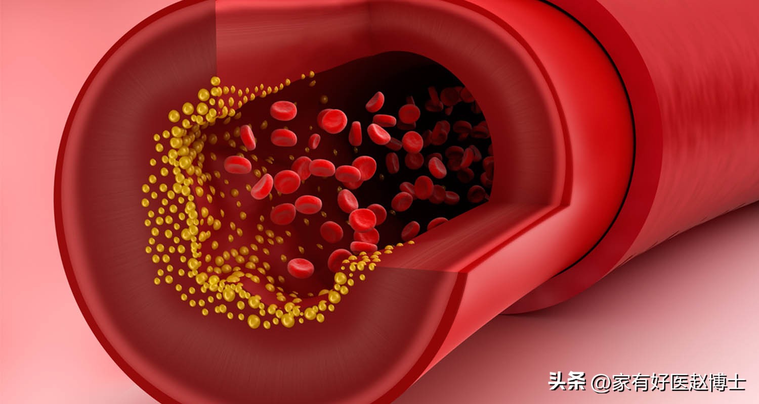 高压不高低压偏高是什么原因,高压不高但是低压高怎么治疗