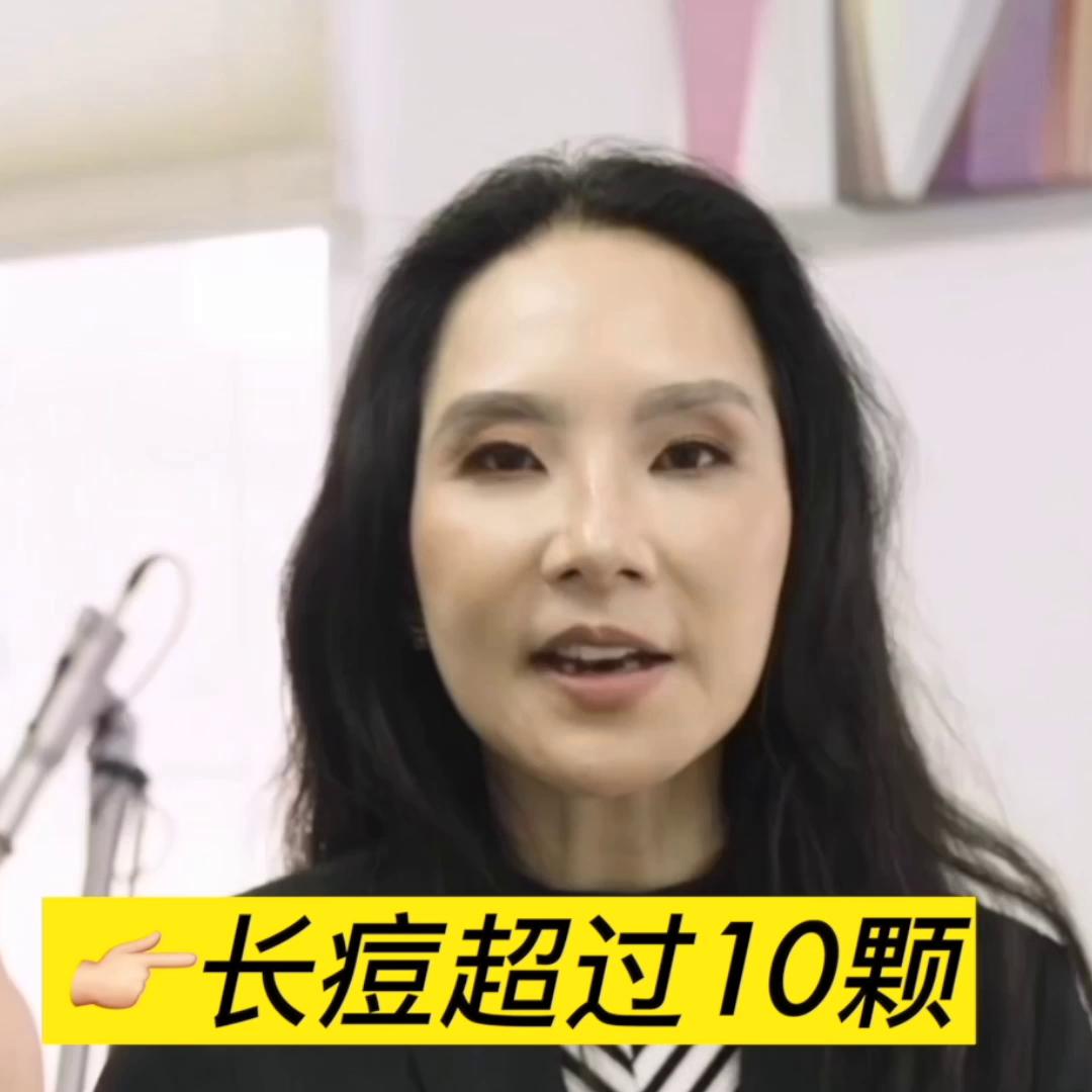 学生党黑头痘痘粉刺多怎么办,痘痘粉刺黑头说拜拜