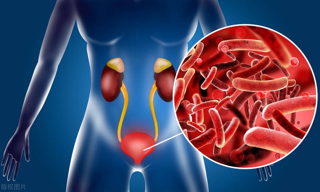 尿路感染什么情况下需要用抗生素,尿路支原体感染抗生素一般用几天