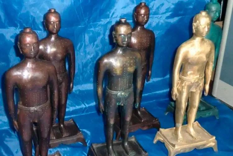 崆峒道人的“长春针法”，三针扎好了“魔症”妇人