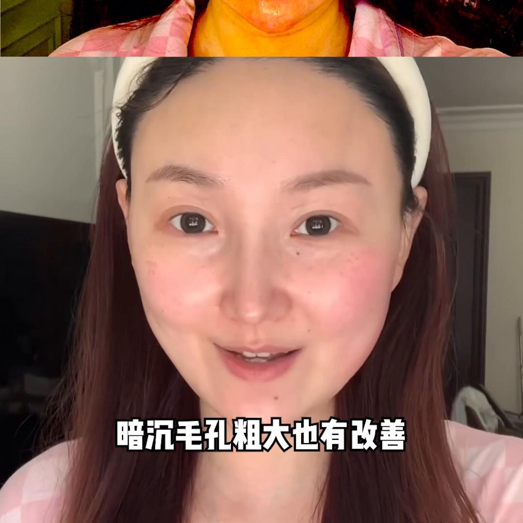 瑞沛的睡眠面膜好用吗,瑞沛面膜和药丸面膜哪个好