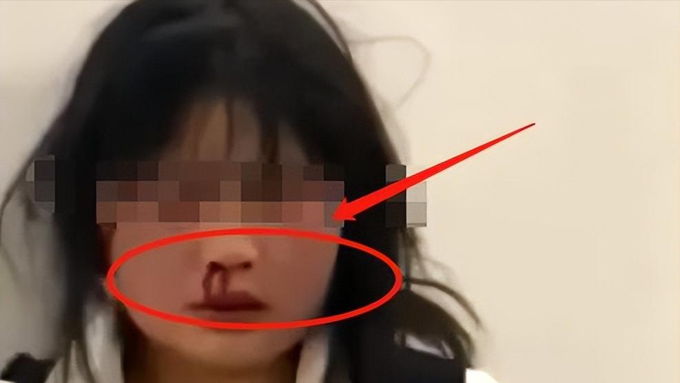 16岁女孩被霸凌去医院,13岁女孩被霸凌精神失常