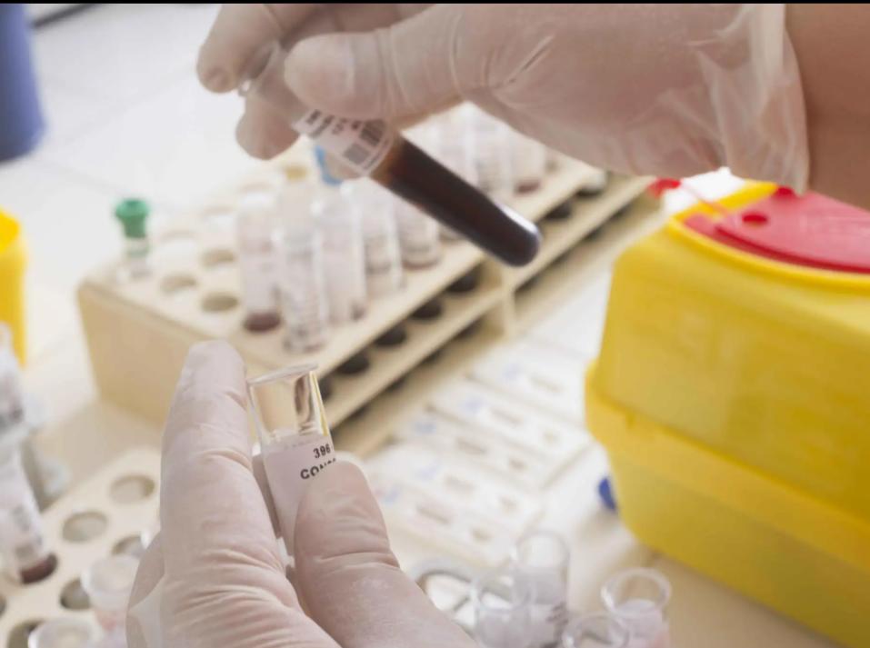 泰国艾滋病最高的地方,泰国你可能不知道的事件