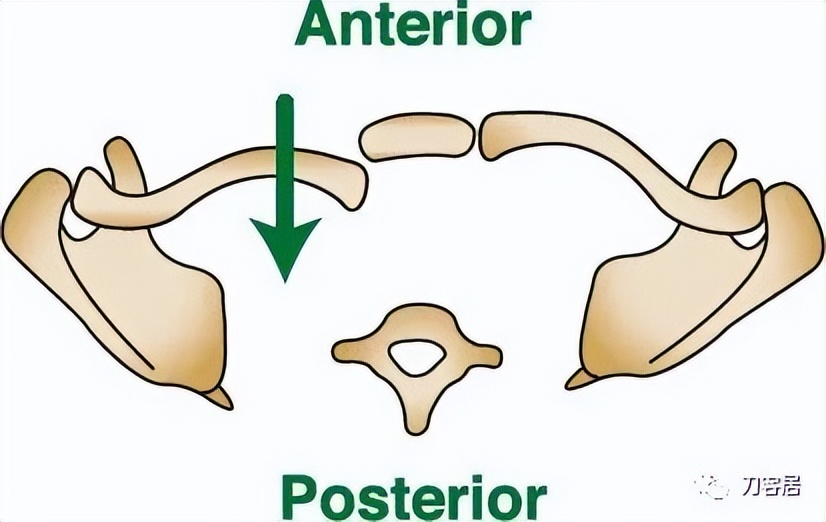 儿童锁骨骨折保守治疗的弊端,锁骨粉碎骨折错位不处理会愈合吗