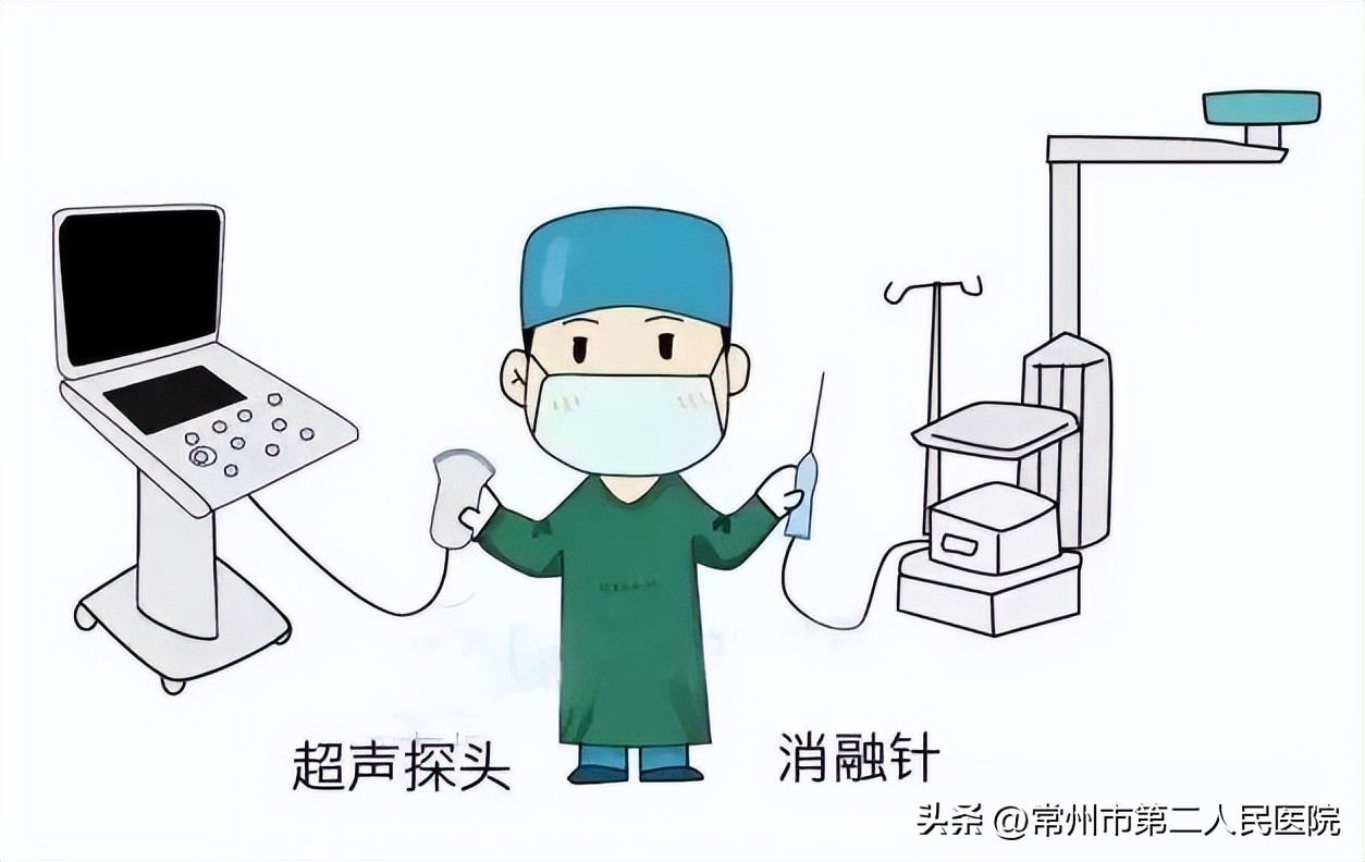 冷冻消融微创手术治肿瘤,精准微创治疗肿瘤