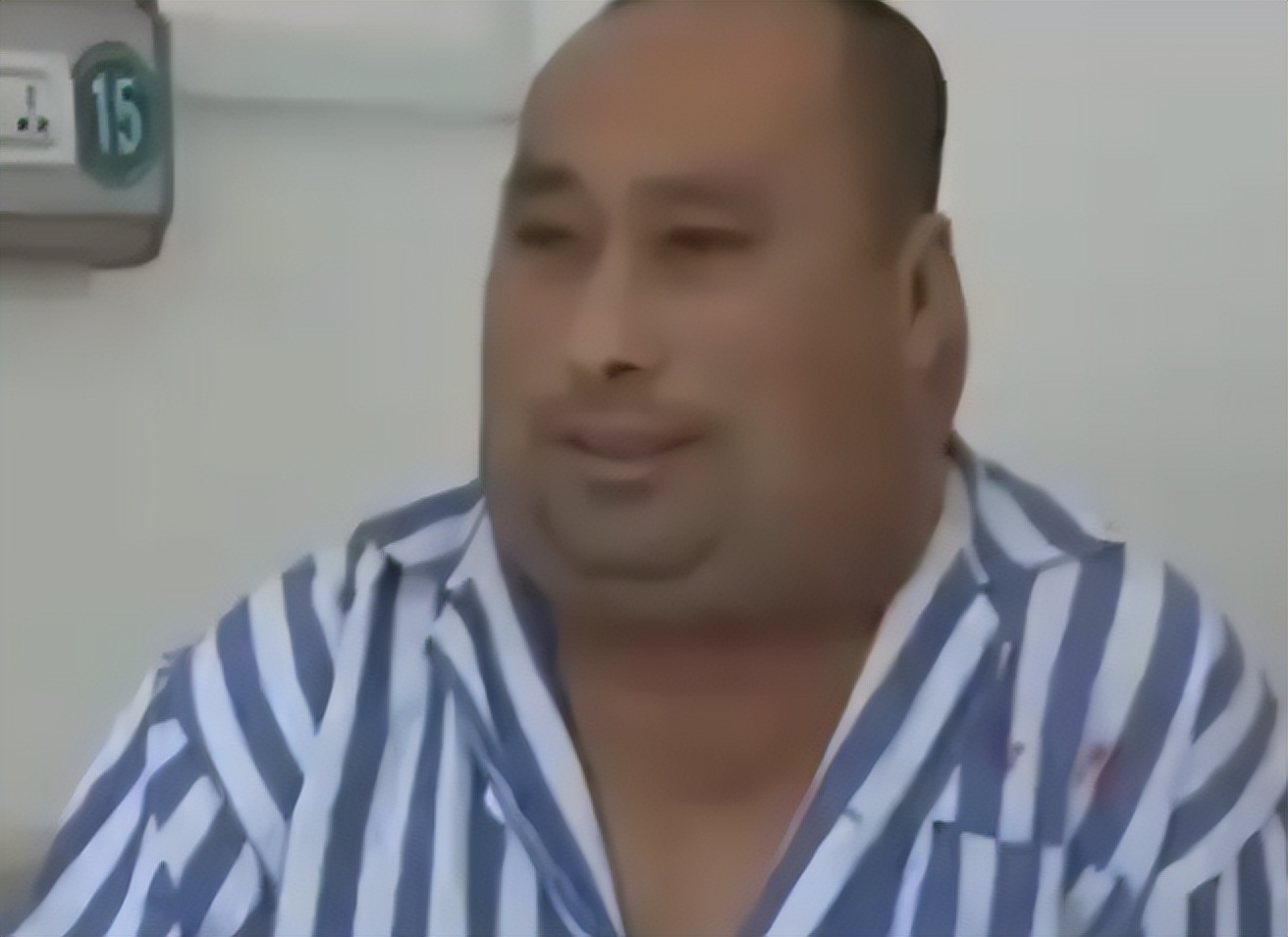 62岁大叔喝出河马脖,辽宁男子喝酒成河马