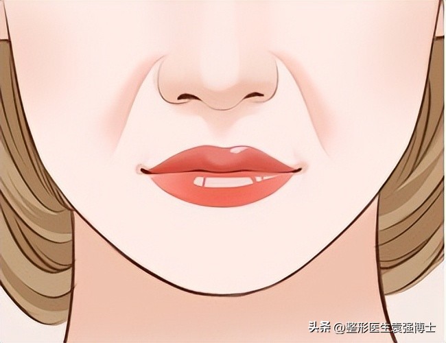 不做拉皮如何改善法令纹,法令纹严重拉皮可以改善吗