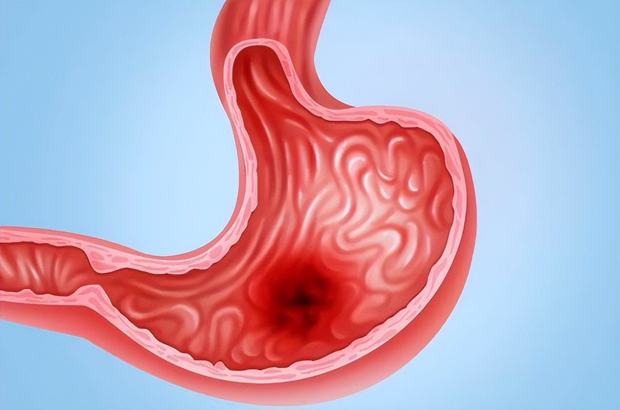 便宜又效果好的甲硝唑,几十块的甲硝唑和几块钱的区别