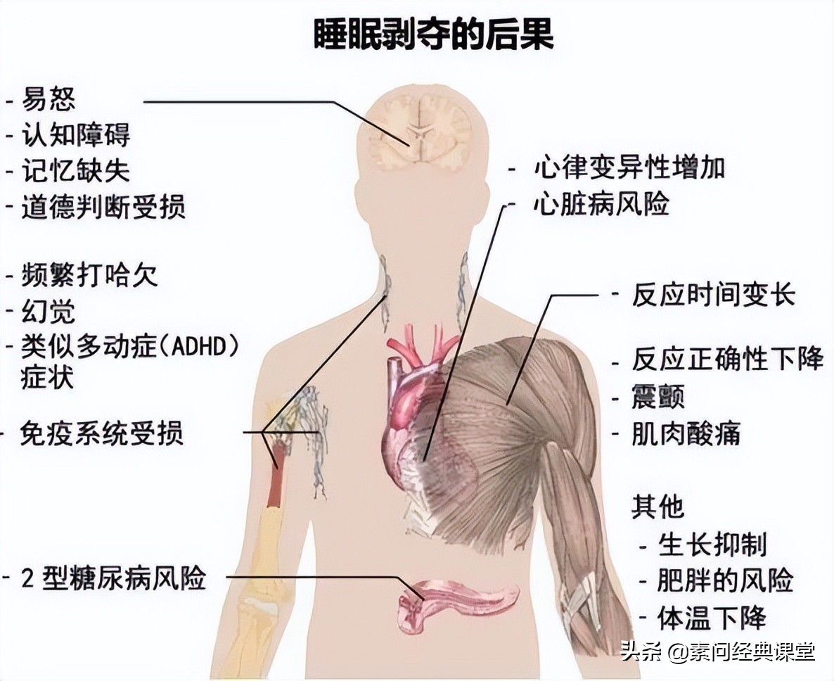 熬夜急救的十个方法,熬夜中医怎么补救最快最有效