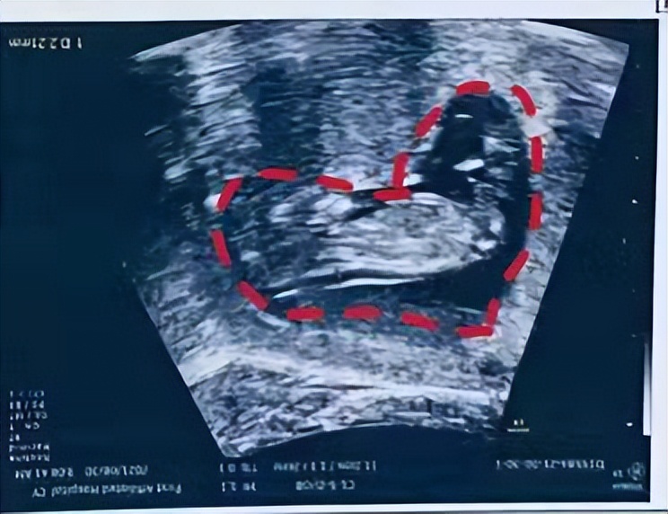 牟方祥在哪个医院,牟方祥医生去哪里了