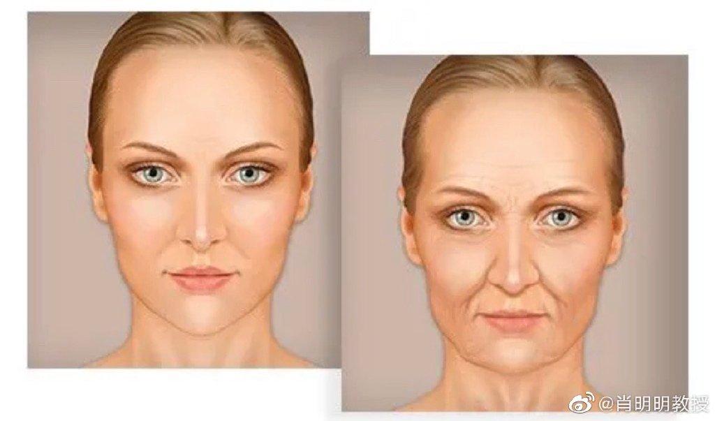 川字纹法令纹最好治疗方法,35岁法令纹类型