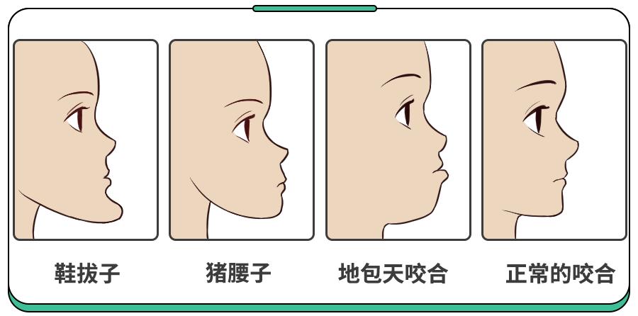 是不是所有不整齐的牙都可以矫正,牙齿不是特别不齐有必要矫正吗
