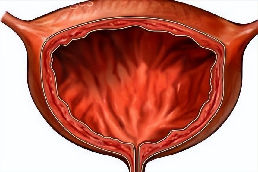 手术插尿管导致后遗症,做完手术插尿管有什么坏处吗