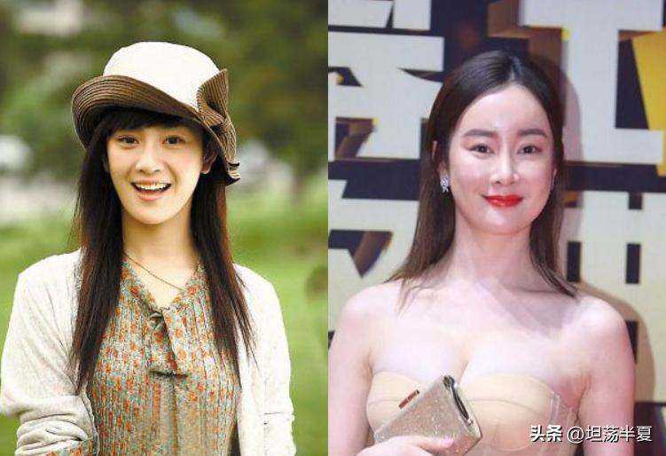 那些整容失败的女星你还记得哪些,盘点整容失败惨不忍睹女星