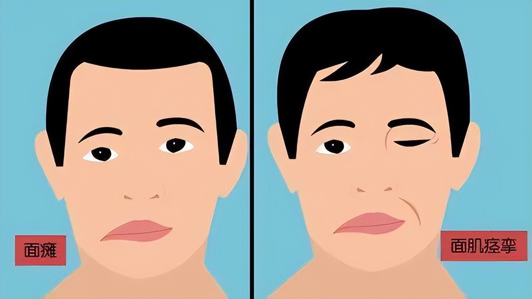 眼皮为什么会跳,为什么眼皮会跳动