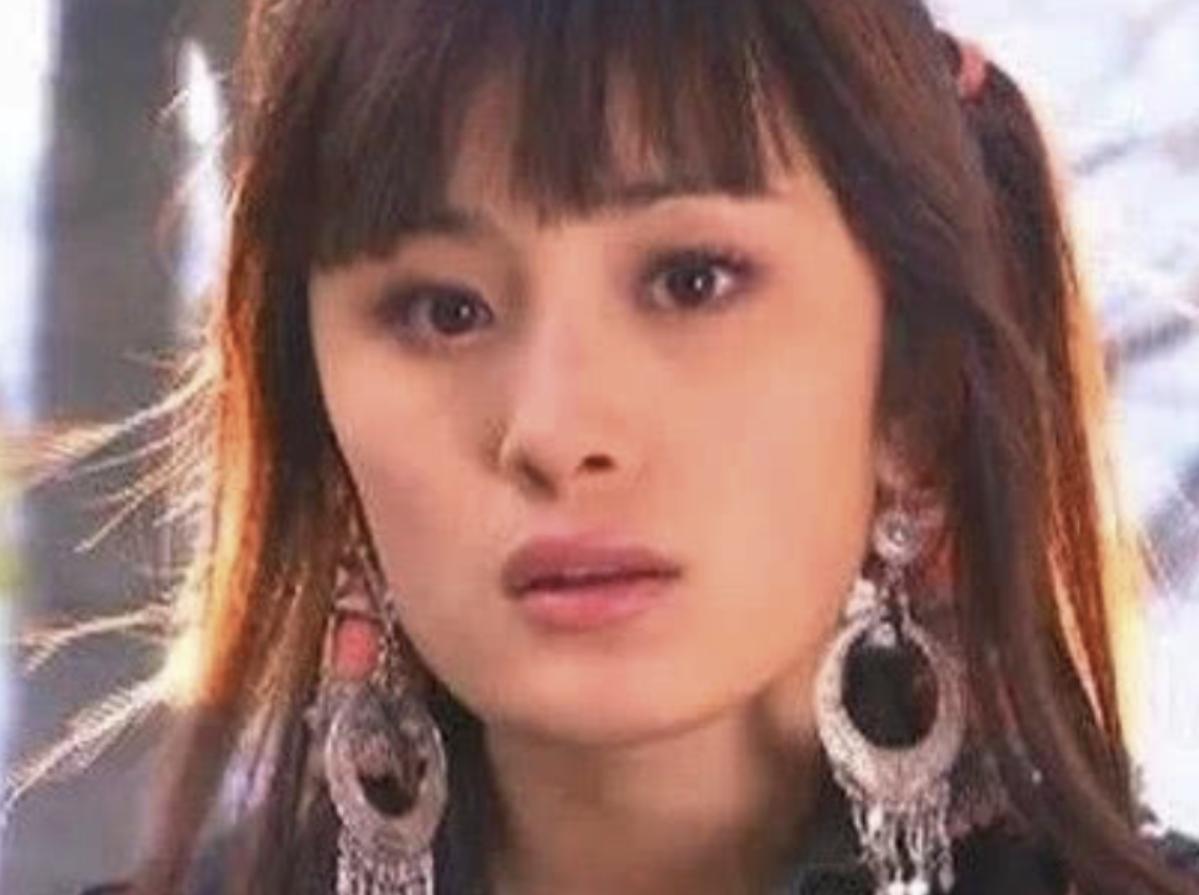 哪些明星整容后遗症越来越严重,整容明星后遗症对比图片