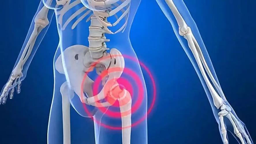 骨盆趾骨骨折后最佳的物理疗法,骨科创伤的救治