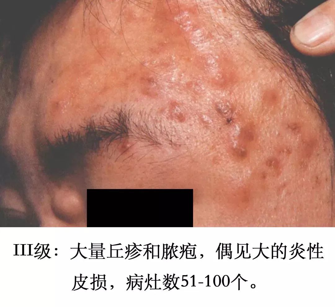 养成干净脸的最好方法,养成干净脸