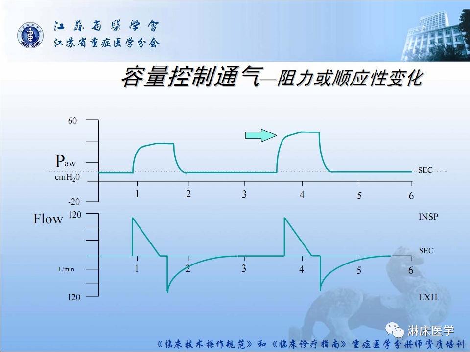 机械通气患者气道管理ppt,机械通气基础知识ppt
