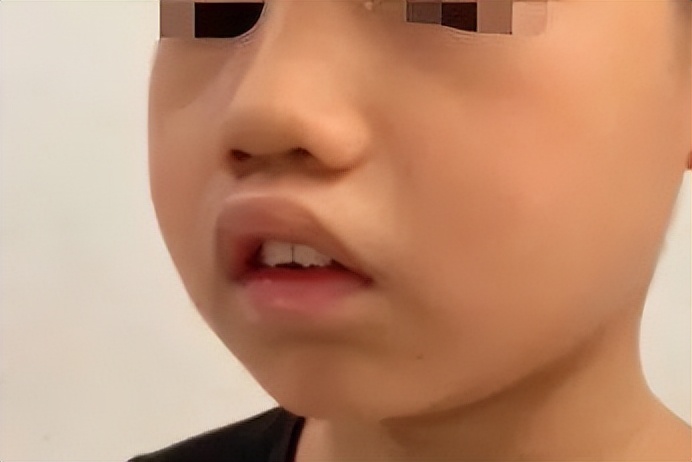 男孩打呼噜有什么好方法治疗吗,17岁的男孩打呼噜怎么回事