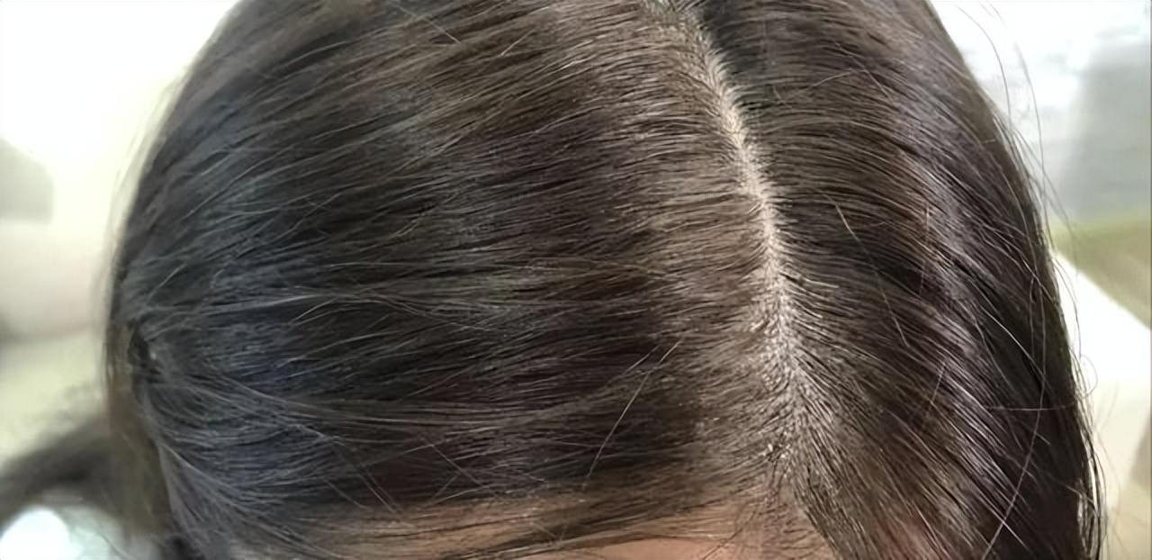 洗发水排名前十名推荐海飞丝,海飞丝洗发水红黑榜