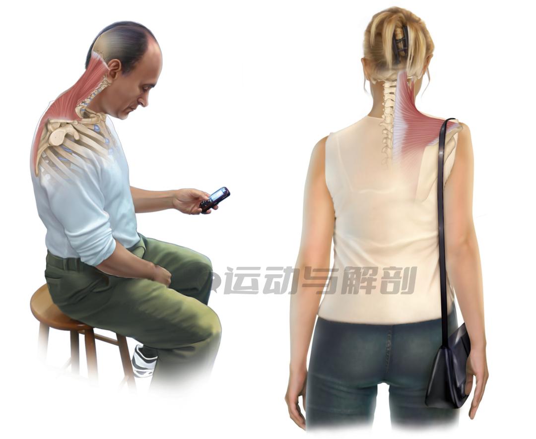 肩胛提肌这块肌肉经常被我们过度代偿,你有没有中过招?