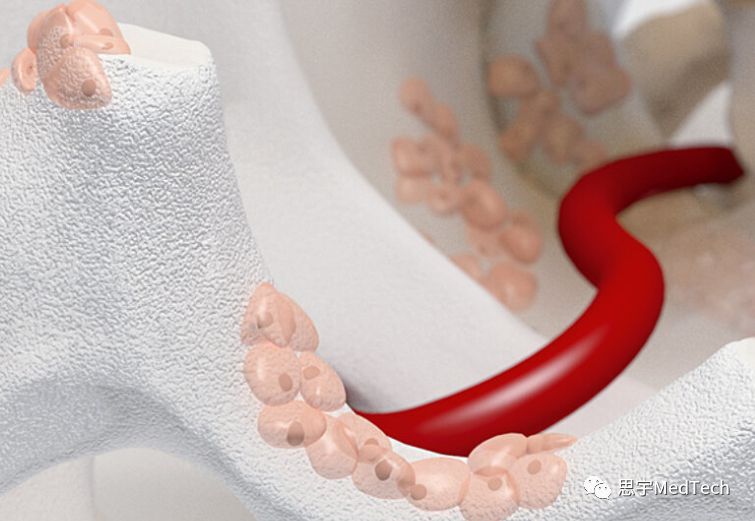 骨再生大咖:瑞士盖氏的故事