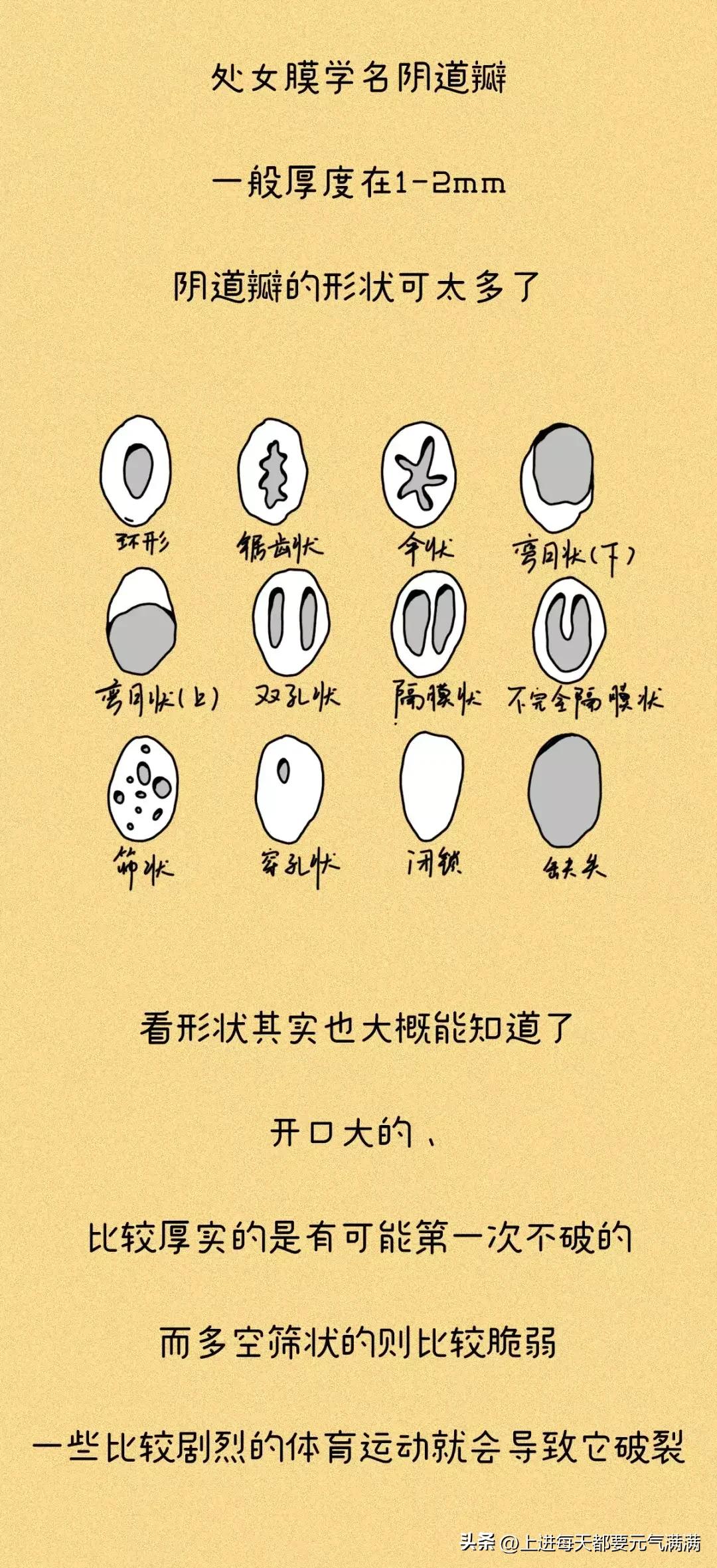 处女膜，到底是什么样子的呢？