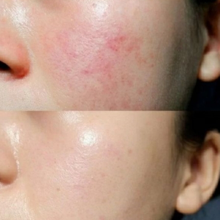 孕期适合的大牌水乳,孕期的平价水乳推荐测评