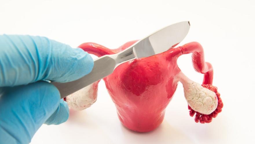 女性切除子宫以后还能来月经吗,年轻女性切除子宫后会有什么影响