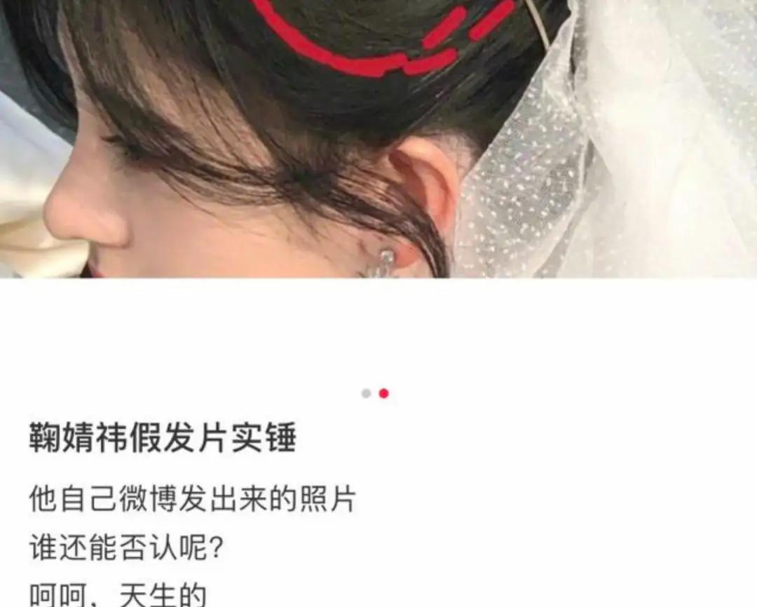 心机女孩鞠婧祎:被潘玮柏刁难拒绝王思聪求爱,整容遭贾玲内涵