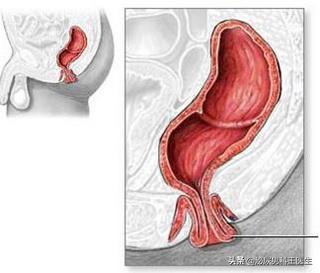 肛门瘙痒潮湿有分泌物怎么治疗,肛门潮湿还痒是什么症状
