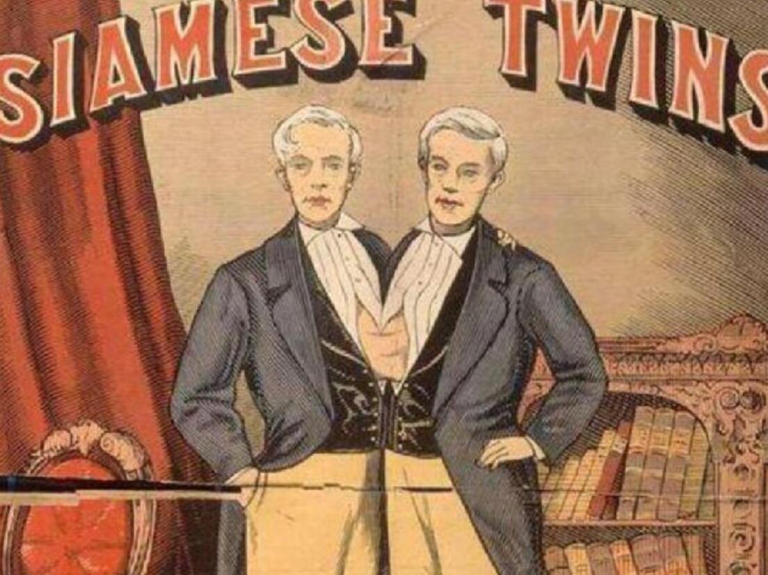 连体人该怎么结婚生子,邦克兄弟连体人