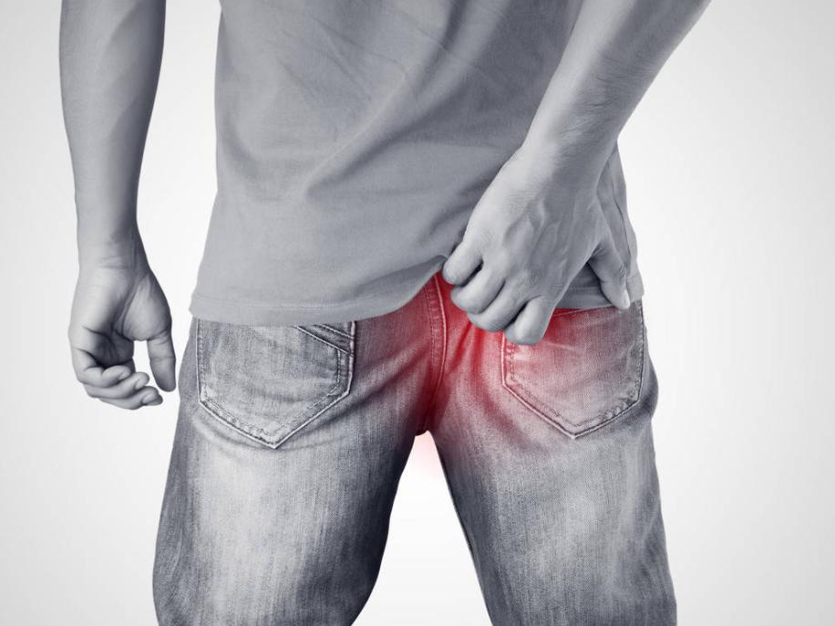 肛门周围潮湿瘙痒到底怎么治疗,肛门周围潮湿瘙痒是怎么治疗