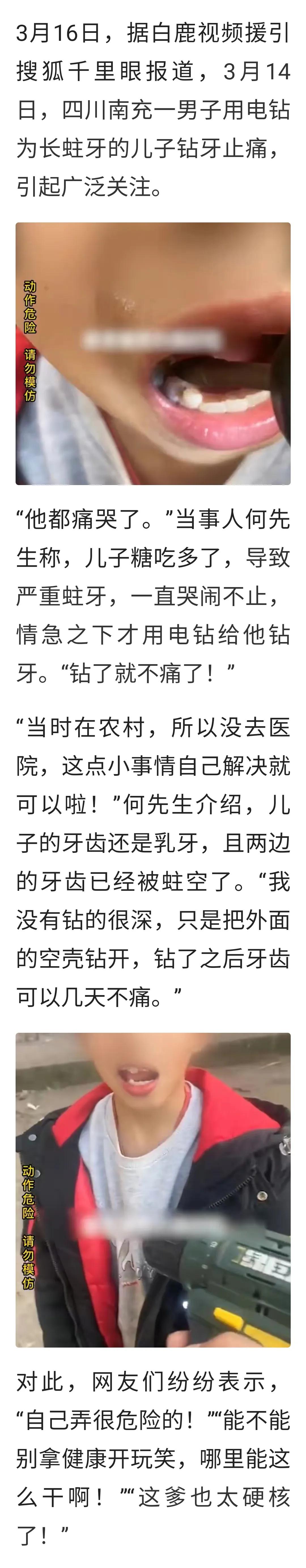 小男孩得了蛀牙必须拔牙,爸爸用电钻给儿子钻蛀牙后续