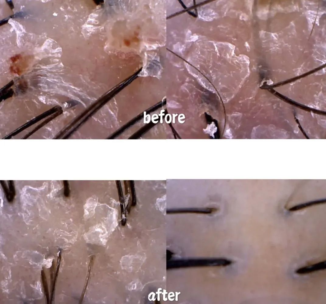 最简单自己弄头发,教大家如何在家打理头发