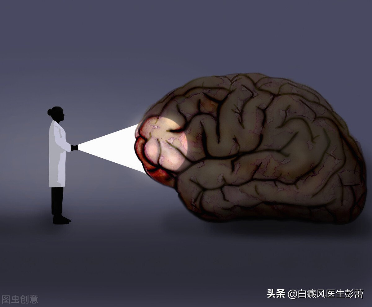 308准分子激光白癜风,308准分子治疗白癜风副作用