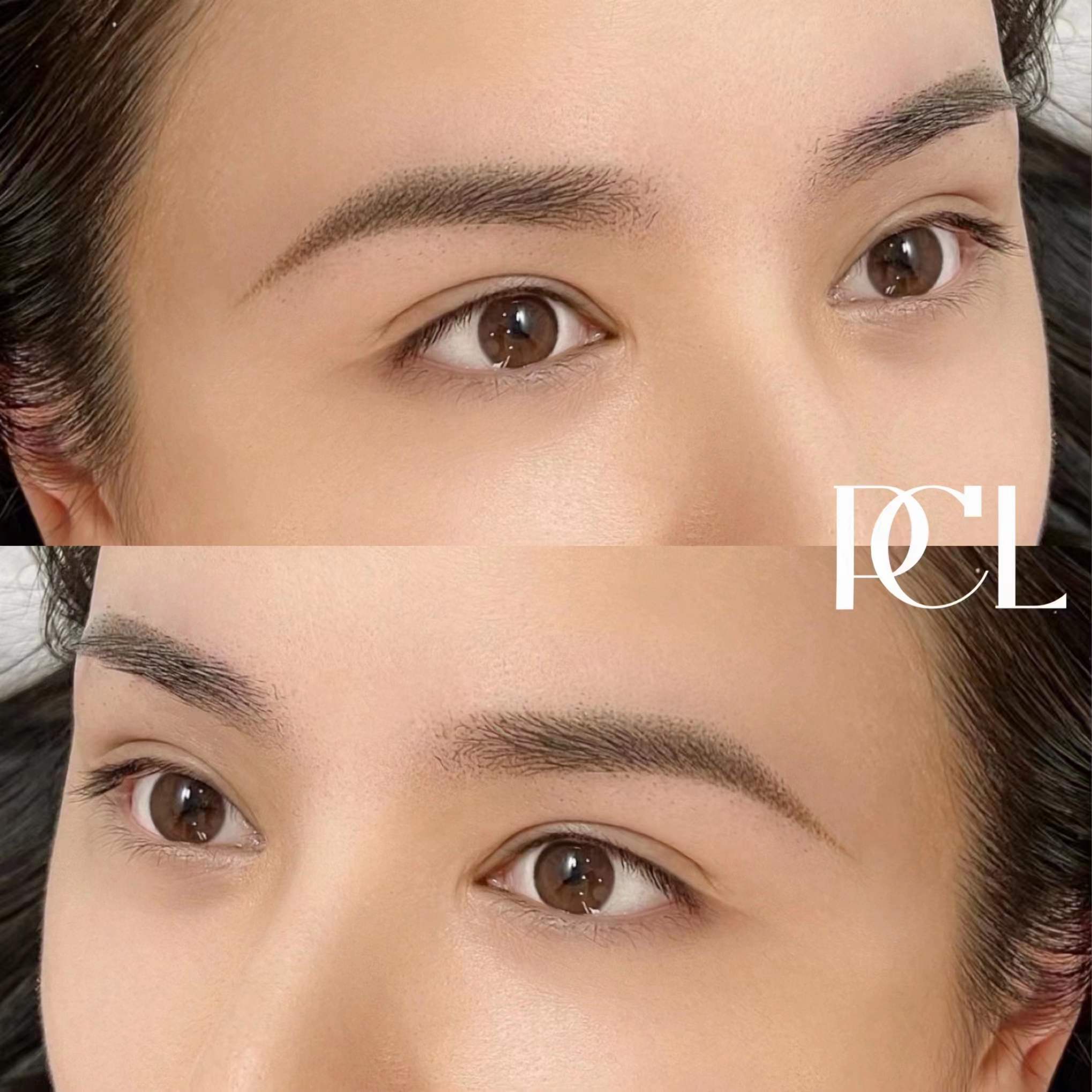 零结痂雾眉做后效果图,零结痂雾眉七天过程图