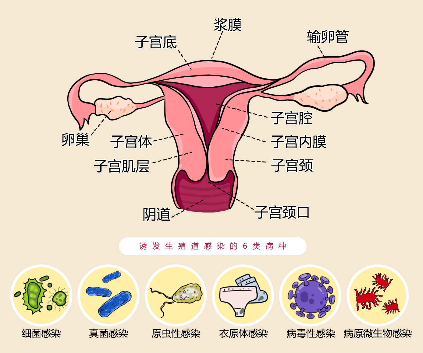 瘙痒不适、炎症反复？女性生殖道感染不可轻视，警惕这6种妇科病