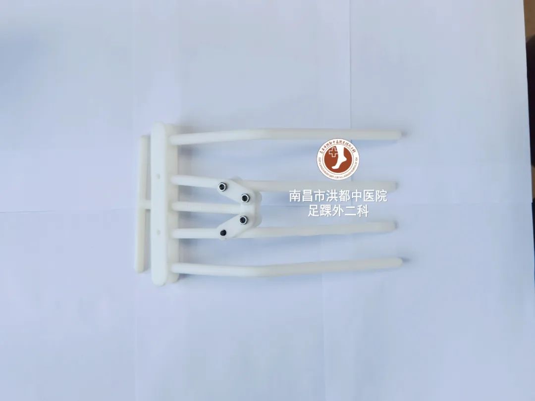 足球运动员韧带断裂修复费用,足球运动员断腿手术