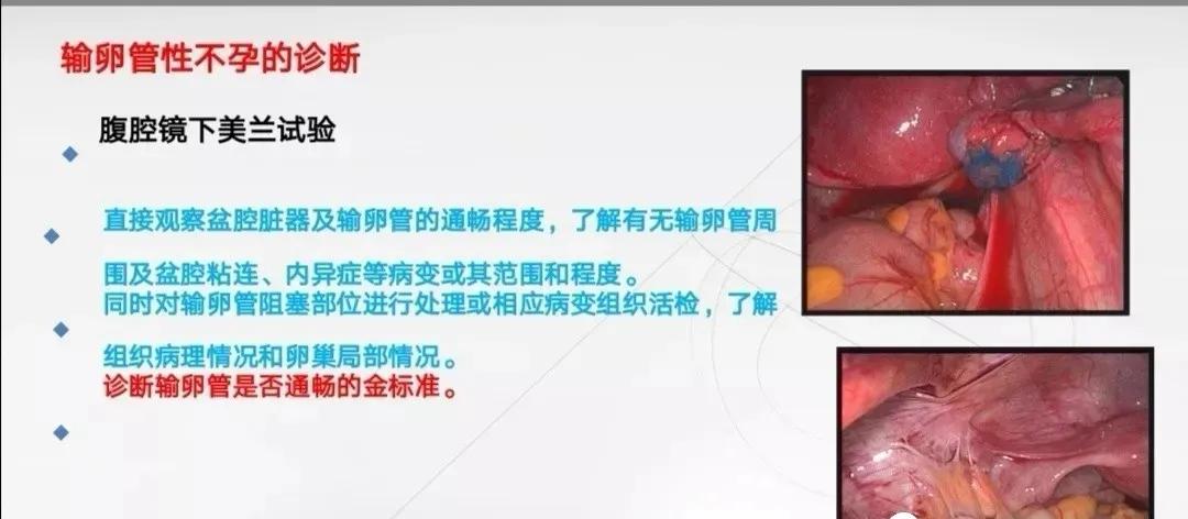 输卵管检查需要多少钱?输卵管检查方法有哪些?