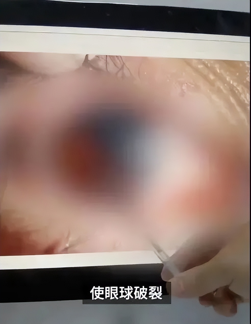 保温杯里泡枸杞有危险吗,保温杯泡枸杞有什么危害吗