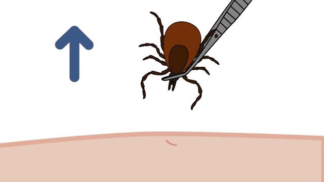 夏季常见蚊虫叮咬图鉴,女孩被家人吸血10年