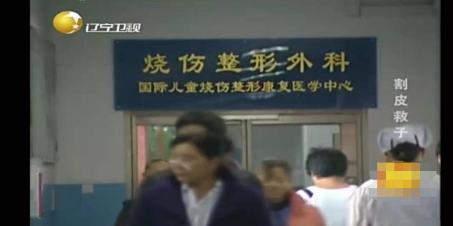 切肤之爱真实上演，河北妈妈割皮救子，就算割光全身的皮也不怕