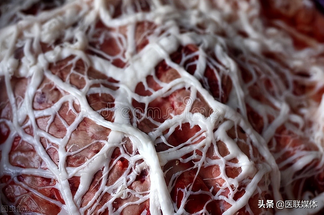 肺气虚咳嗽吃什么能改善,咳嗽肺气虚的最佳食疗方法