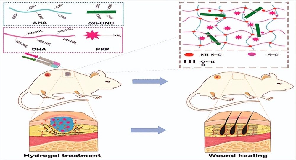 郑大/武汉纺织：自愈透明质酸纳米复合水凝胶