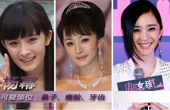 有一种倔强叫做没整容,有种倔强叫不承认整容