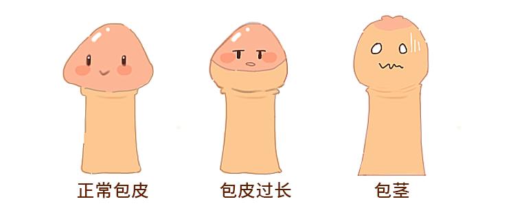 男性一生中最常见的五种疾病，你“中枪”了吗？